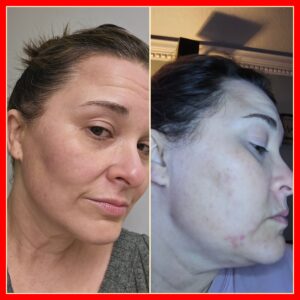 Flawless Skin – Clean, Nourish, Exfoliate Set