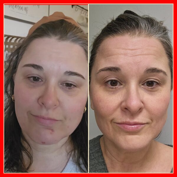 flawless skin clean, nourish, exfoliate set